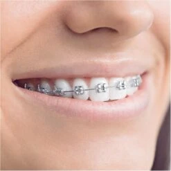 Braun Oral-B Teen, Elektrische Zahnbürste (schwarz/weiß) -Körperpflege Store Braun Oral B Teen Elektrische Zahnb rste@@9iotebl1 9